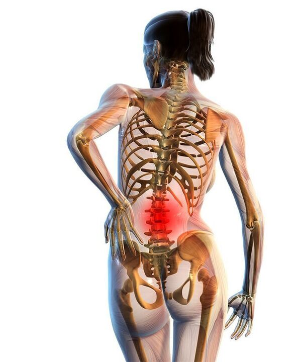 Gerri-bizkarrezurreko osteokondrosia gertatzen da gehienetan